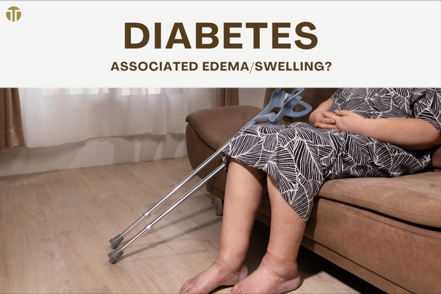 Compression Therapy for Diabetes Management: A Comprehensive Overview