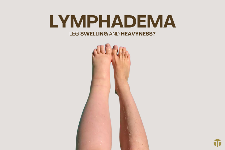 Compression for Lymphedema