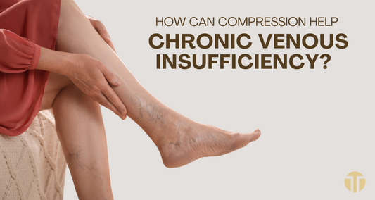 Managing Chronic Venous Insufficiency: How Compression Wear Can Help